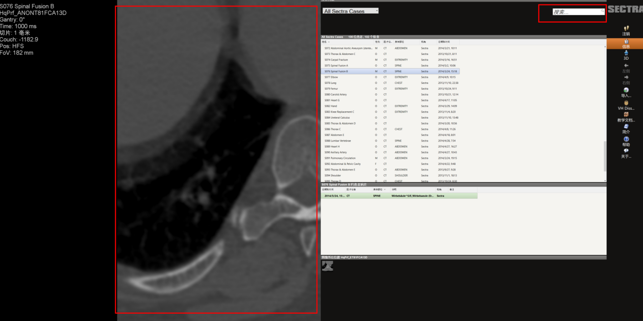 批量伤员救治推演及手术计划系统
